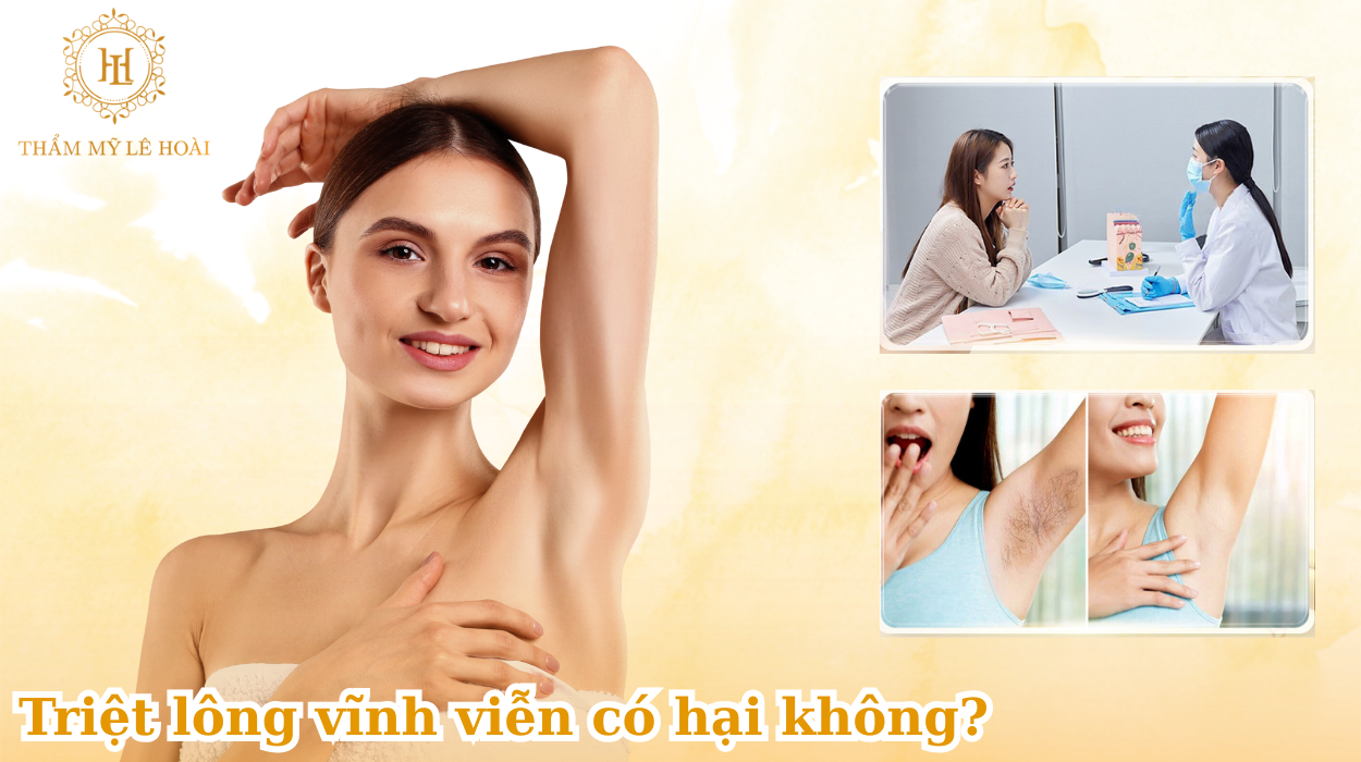 TRIỆT LÔNG CÓ HẠI CHO SỨC KHỎE KHÔNG