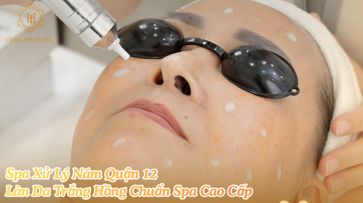 Spa Xử Lý Nám Quận 12 – Làn Da Trắng Hồng Chuẩn Spa Cao Cấp | Thẩm mỹ Lê Hoài